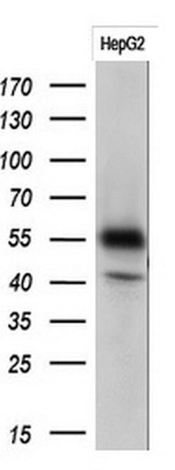 PPAT Monoclonal Antibody (OTI3C6), TrueMAB , OriGene 100 &mu;L; Unconjugated:Antibodies,