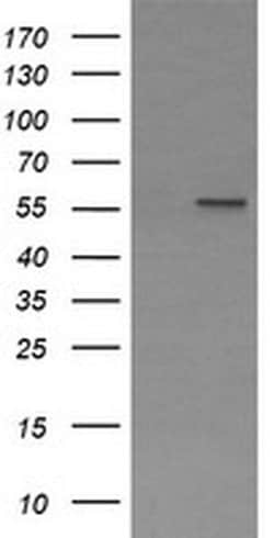 PPAT Monoclonal Antibody (OTI2C2), TrueMAB , OriGene 30 &mu;L; Unconjugated:Antibodies,