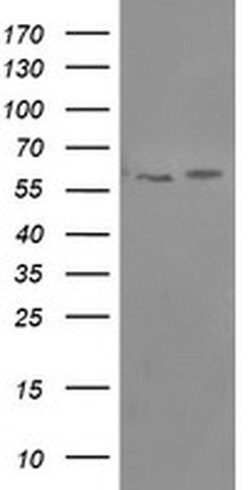 PPAT Monoclonal Antibody (OTI1C7), TrueMAB , OriGene:Antibodies:Primary