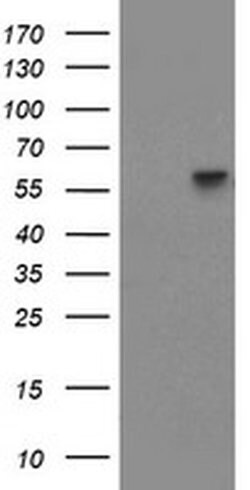 PPAT Monoclonal Antibody (OTI1E1), TrueMAB , OriGene:Antibodies:Primary