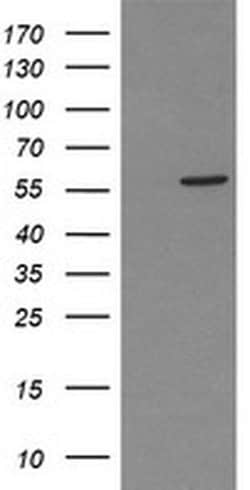 PPAT Monoclonal Antibody (OTI1D9), TrueMAB , OriGene 100 &mu;L; Unconjugated:Antibodies,