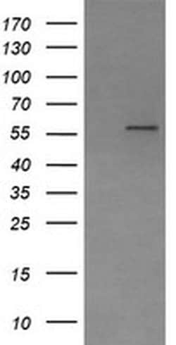 PPAT Monoclonal Antibody (OTI1B11), TrueMAB , OriGene 100 &mu;L; Unconjugated:Antibodies,
