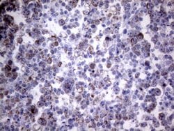 PPIF Monoclonal Antibody (OTI6E7), TrueMAB , OriGene 100 &mu;L; Unconjugated:Antibodies,