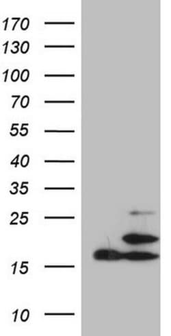 PPIF Monoclonal Antibody (OTI4D3), TrueMAB , OriGene 100 &mu;L; Unconjugated:Antibodies,