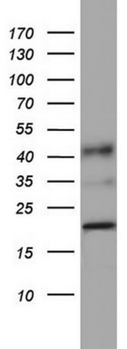 PPIH Monoclonal Antibody (OTI1C6), TrueMAB , OriGene 100 &mu;L; Unconjugated:Antibodies,