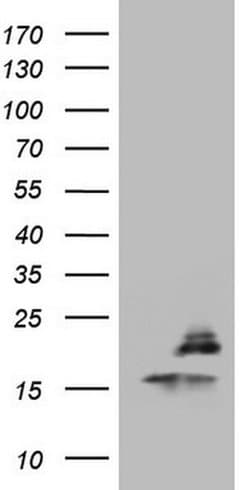 PPIL1 Monoclonal Antibody (OTI2F1), TrueMAB , OriGene 30 &mu;L | Buy Online | Origene Technologies | Fisher Scientific