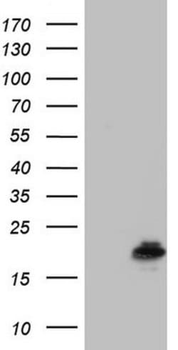 PPIL1 Monoclonal Antibody (OTI8F8), TrueMAB , OriGene 30 &mu;L; Unconjugated:Antibodies,