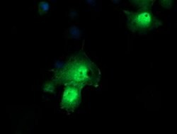 PPIL3 Mouse anti-Human, Clone: OTI1D4, lyophilized, TrueMAB 100 &mu;g;
