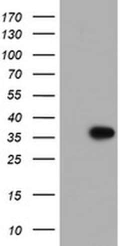 PPIL6 Monoclonal Antibody (OTI3F4), TrueMAB , OriGene 100 &mu;L; Unconjugated:Antibodies,