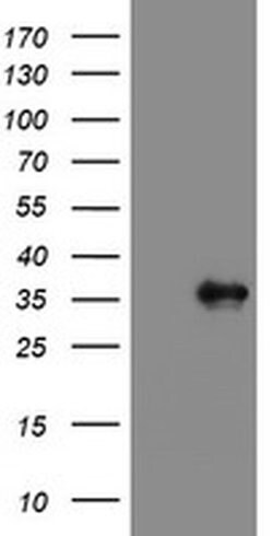 PPIL6 Monoclonal Antibody (OTI4C1), TrueMAB , OriGene 100 &mu;L; Unconjugated:Antibodies,