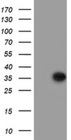 PPIL6 Monoclonal Antibody (OTI2G3), TrueMAB , OriGene 30 &mu;L | Buy Online | OriGene | Fisher Scientific