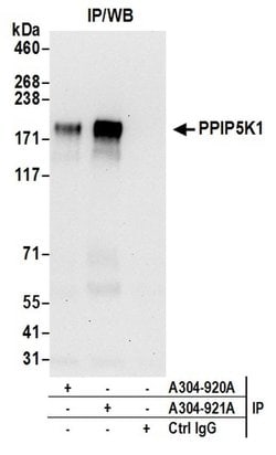 PPIP5K1/HISPPD2A Rabbit anti-Human, Polyclonal, Bethyl Laboratories 100