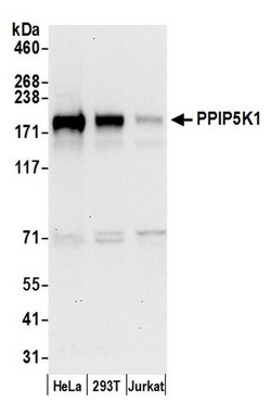 PPIP5K1/HISPPD2A Rabbit anti-Human, Polyclonal, Bethyl Laboratories 100