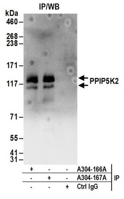PPIP5K2 Rabbit anti-Human, Mouse, Polyclonal, Bethyl Laboratories 100 &mu;L;