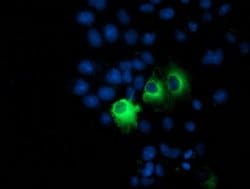 PPM1B Monoclonal Antibody (OTI3C9), TrueMAB , OriGene 100 &mu;L; Unconjugated:Antibodies,