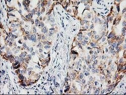 PPM1B Monoclonal Antibody (OTI3E8), TrueMAB , OriGene 100 &mu;L | Buy Online | OriGene | Fisher Scientific