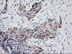 PPM1B Monoclonal Antibody (OTI3E8), TrueMAB , OriGene 100 &mu;L | Buy Online | OriGene | Fisher Scientific