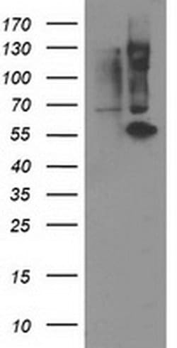 PPM1B Monoclonal Antibody (OTI2H5), TrueMAB , OriGene 100 &mu;L; Unconjugated:Antibodies,