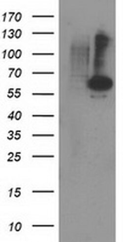 PPM1B Monoclonal Antibody (OTI3C2), TrueMAB , OriGene 100 &mu;L; Unconjugated:Antibodies,
