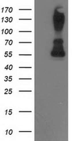 PPM1B Monoclonal Antibody (OTI3A10), TrueMAB , OriGene 30 &mu;L; Unconjugated:Antibodies,