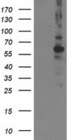 PPM1B Mouse anti-Canine, Human, Rat, Clone: OTI3F2, lyophilized, TrueMAB