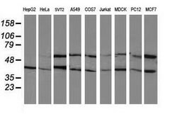PPM1B Mouse anti-Canine, Human, Rat, Clone: OTI3F2, lyophilized, TrueMAB