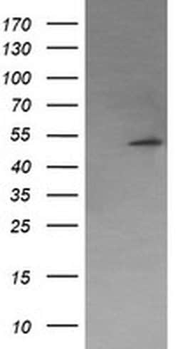 PPM1B Monoclonal Antibody (OTI3C9), TrueMAB , OriGene 100 &mu;L; Unconjugated:Antibodies,