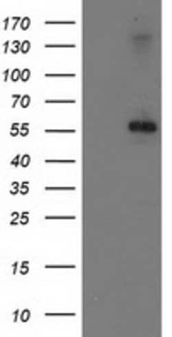 PPM1B Mouse anti-Human, Clone: OTI2D9, lyophilized, TrueMAB 100 &mu;g;