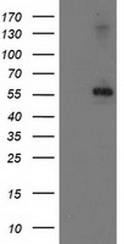 PPM1B Monoclonal Antibody (OTI2D9), TrueMAB , OriGene 30 &mu;L; Unconjugated:Antibodies,