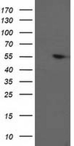 PPM1B Monoclonal Antibody (OTI3G9), TrueMAB , OriGene:Antibodies:Primary