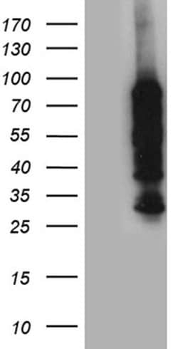 PPM1D Monoclonal Antibody (OTI4H3), TrueMAB , OriGene:Antibodies:Primary