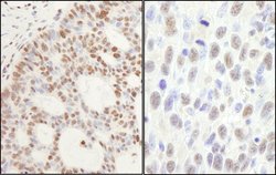 PPM1G Rabbit anti-Human, Mouse, Polyclonal, Bethyl Laboratories 100 &mu;L;