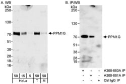 PPM1G Rabbit anti-Human, Mouse, Polyclonal, Bethyl Laboratories 100 &mu;L;