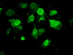 PPME1 Mouse anti-Human, Clone: OTI6H5, lyophilized, TrueMAB 100 &mu;g;