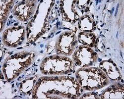 PPME1 Mouse anti-Human, Clone: OTI6H5, lyophilized, TrueMAB 100 &mu;g;