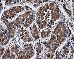 PPME1 Mouse anti-Human, Clone: OTI6H5, lyophilized, TrueMAB 100 &mu;g;