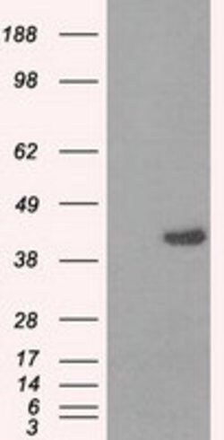 PPME1 Mouse anti-Human, Clone: OTI10A12, lyophilized, TrueMAB 100 &mu;g | Buy Online | OriGene | Fisher Scientific
