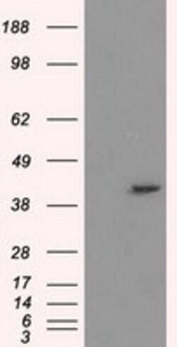 PPME1 Mouse anti-Human, Clone: OTI6H5, lyophilized, TrueMAB 100 &mu;g;