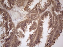 PPP1CA Monoclonal Antibody (OTI6E5), TrueMAB , OriGene 100 &mu;L; Unconjugated:Antibodies,