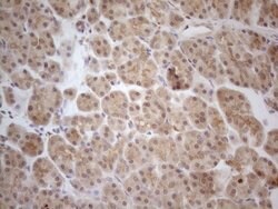 PPP1CA Monoclonal Antibody (OTI6E5), TrueMAB , OriGene 100 &mu;L; Unconjugated:Antibodies,