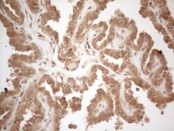 PPP1CA Monoclonal Antibody (OTI6E5), TrueMAB , OriGene 100 &mu;L; Unconjugated:Antibodies,