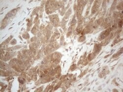 PPP1CA Monoclonal Antibody (OTI6E5), TrueMAB , OriGene 100 &mu;L; Unconjugated:Antibodies,