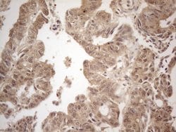 PPP1CA Monoclonal Antibody (OTI6E5), TrueMAB , OriGene 100 &mu;L; Unconjugated:Antibodies,