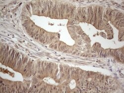 PPP1CA Monoclonal Antibody (OTI6E5), TrueMAB , OriGene 100 &mu;L; Unconjugated:Antibodies,