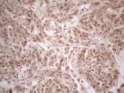PPP1CA Monoclonal Antibody (OTI6E5), TrueMAB , OriGene 100 &mu;L; Unconjugated:Antibodies,
