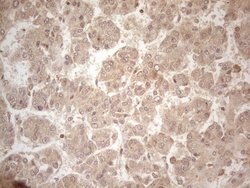 PPP1CA Monoclonal Antibody (OTI6E5), TrueMAB , OriGene 100 &mu;L; Unconjugated:Antibodies,