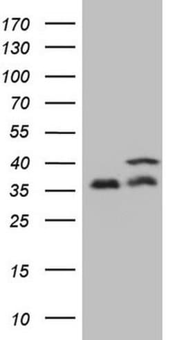 PPP1CA Monoclonal Antibody (OTI6E5), TrueMAB , OriGene 100 &mu;L; Unconjugated:Antibodies,