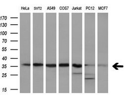 PPP1CA Monoclonal Antibody (OTI6E5), TrueMAB , OriGene 100 &mu;L; Unconjugated:Antibodies,
