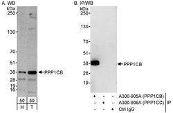 PPP1CB Rabbit anti-Human, Polyclonal, Bethyl Laboratories 100 &mu;L; Unconjugated:Antibodies,