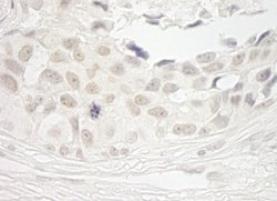 PPP1CB Polyclonal Antibody, Bethyl Laboratories 100 &mu;L; Unconjugated:Antibodies,